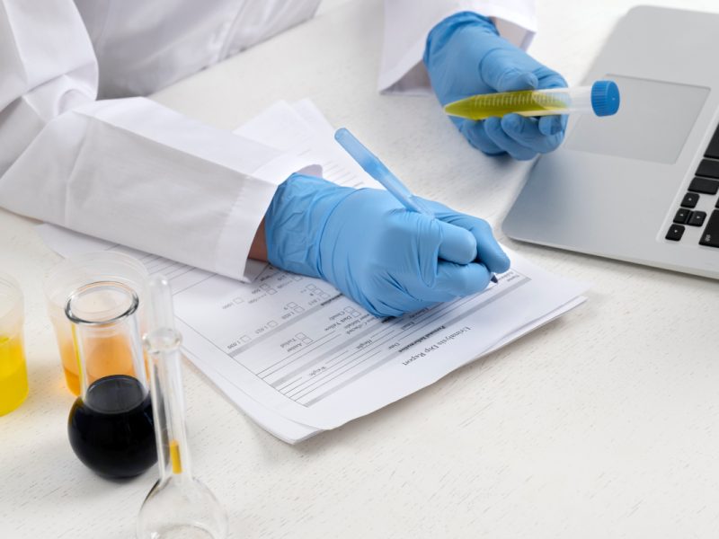 lab-test